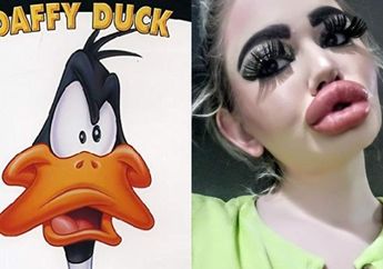Habiskan Nyaris Rp 60 Juta untuk 17 Kali Suntik Bibir, Wanita yang Ingin Tampil Bak Barbie Justru Dijuluki Daffi Duck Sekaligus Dicap Pemilik Bibir Terbesar di Dunia, Lihat Sosoknya!