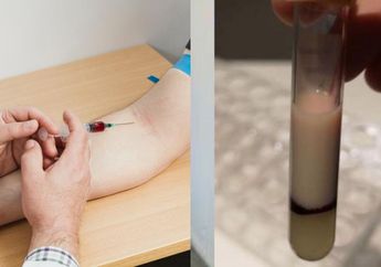 Auto Takut Sentuh Rokok Selamanya, Dokter ini Syok Lihat Darah Perokok Berubah Menjadi Sekental Susu