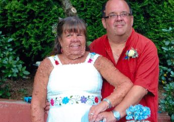 Sekujur Tubuhnya Sama-sama Ditumbuhi Benjolan, Pasangan Suami Istri Mengidap Kelainan Genetik Neurofibromatosis, Beruntung Punya Satu Sama Lain