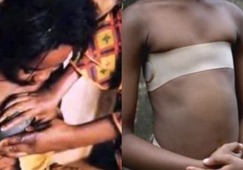 Hindari Pelecehan Seksual, Orang Tua Gadis Muda di Wilayah ini Memilih Setrika Dada Putrinya Sampai Rata