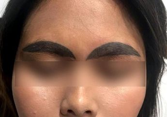 Maksud Hati Ingin Tampil Cantik, Wajah Wanita Thailand Ini Malah Terlihat Aneh Usai Lakukan Tato Alis Permanen, Beruntung Nasib Buruknya Diselamatkan