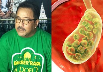 Dulu Lakukan Operasi di Usia Senja hingga Kehilangan Empedu, Rano Karno Ternyata Mati-matian Hindari Makanan Sejuta Umat Ini, Para Istri Harus Catat!