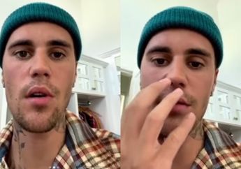 Kondisinya Memilukan hingga Terpaksa Tunda Konser, Ini Penyebab Kelumpuhan Wajah yang Dialami Justin Bieber, Bisa Terjadi Pada Orang yang Pernah Terkena Cacar Air