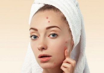 Wajah Anda Mendadak Rimbun Ditumbuhi Jerawat Jelang atau Saat Siklus Menstruasi Berlangsung? Pakar Ungkap Penyebabnya dan Cara Menanganinya