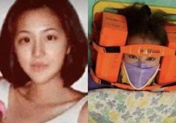 Dulu Dipuja-puja Fans Gegara Kecantikannya, Artis Ini Alami Hidup Miris Usai Kecelakaan, Wajahnya Berubah hingga Tak Dikenali Para Fans dan Dicerai Suami!