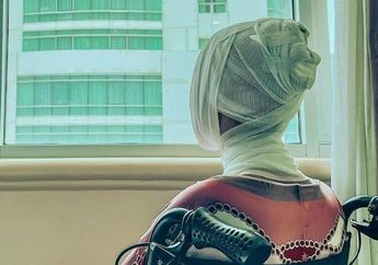 Innalillahi, Penampakan Wajahnya Dinilai Makin Ngeri, Lucinta Luna Pasang Potret Terbarunya, Terlilit Perban Sana-sini sampai Bikin Inul Daratista Elus Dada: Aduh Sayang..