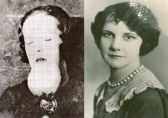 Efek Mengerikan Penggunaan Radium Abad ke-20, Tubuh Alami Pembusukan dari Dalam Hingga Tulang Rahang Lepas