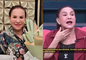Puluhan Tahun Jalani Suntik Silikon Demi Tampil Cantik, Mpok Atiek Kisahkan Pilunya Alami Perubahan Wajah yang Bikin Tak Berani Ngaca: Kayak Nenek Sihir, Serem!