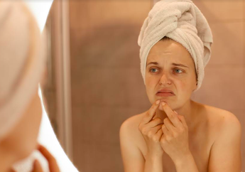 3 Arti Mimpi Wajah Berjerawat, Tak Selalu Pertanda Stres, Ternyata Punya Makna Ini