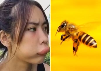 Arti Mimpi Disengat Lebah Ternyata Memiliki Banyak Interpretasi yang Harus Diwaspadai, Waspada dengan Kemungkinan Buruk Ini!