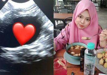 Gak Ada Angin Gak Ada Hujan, Kekeyi Mendadak Unggah Foto Hasil USG Padahal Belum Nikah, Ngaku Alami Ngidam Hingga Berat Badan Naik, Hamil Anak Siapa?