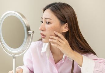 Empat Kandungan Skincare yang Ampuh Buat Atasi Flek Hitam dalam 14 Hari, Sudah Tahu?