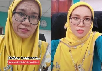 Wajah Ibu Muda Berubah Menua Seperti Nenek-Nenek Setelah Melahirkan, Begini Nasibnya Setelah Dengar Diagnosa Dokter