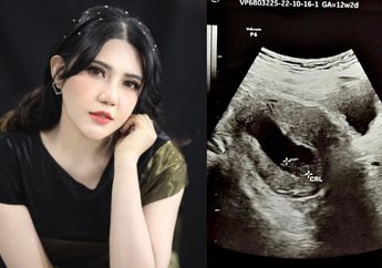 Innalillahi, Via Vallen Sampai Jatuh Pingsan, Sang Biduan Ungkap Fatalnya Mempertahankan Janin yang Tak Berkembang, Harus Tranfusi Darah 4 Kantong