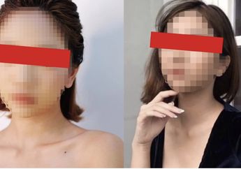 Terungkap Dugaan Penyakit Jiwa yang Diderita AH Pemeran Video Syur Wanita Kebaya Merah, Punya Kartu Kuning dari RSJ Menur