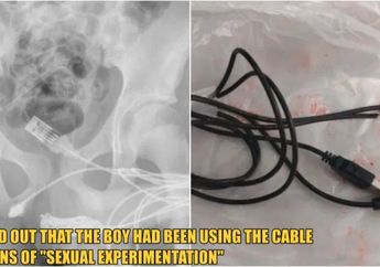 Lakukan Eksperimen Seksual, Kabel USB Auto Nyangkut di Dalam Mr. P Remaja Usia 15 Tahun, Dokter Kebingungan!