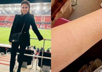 Nonton Suami Tanding di Piala Dunia 2022, Istri Pemain Timnas Jerman Ngeluh Merinding Kedinginan Kena AC Stadion