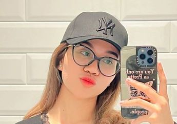 Sering Dihina Pesek, Mayang Adik Vanessa Angel Bela-belain Keluar Duit Rp 50 Juta Buat Operasi Hidung, Begini Kondisinya Kini