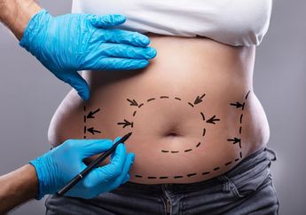 Selebgram Ella Nanda Tewas Saat Jalani Sedot Lemak, Pihak Kepolisian Jawab Kemungkinan Bakal Autopsi Jenazah Korban