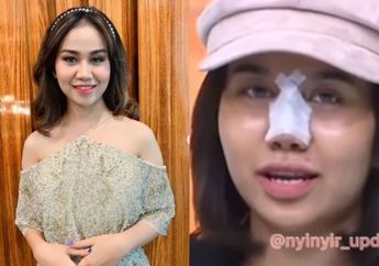Mayang Nekat Oplas Gegara Lelah Diejek Pesek, Adik Vanessa Angel Berharap Hidung Barunya Bawa Rezeki