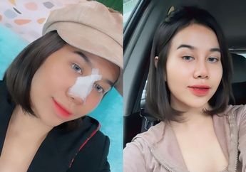 Mayang Adik Vanessa Angel Cuek Dihujat Netizen Usai Operasi Bagian Hidung
