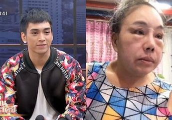 Sudah 14 Kali Menikahi Berondong Belum Juga Puas, Nenek 62 Tahun ini Berakhir Sengsara Harta Dibawa Kabur Hingga Wajah Rusak karena Gagal Oplas