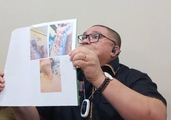 Razman Arif Nasution Menggebu-gebu Perlihatkan Bukti Foto Percobaan Bunuh Diri yang Dilakukan Iqlima Kim, Sebut Mantan Kliennya Tertekan