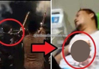 Niat Hati Rayakan Tahun Baru, Jari Wakil Bupati Kaur Nyaris Putus Gegara Kena Ledakan Kembang Api di Tangannya, Begini Kronologinya yang Bikin Merinding!