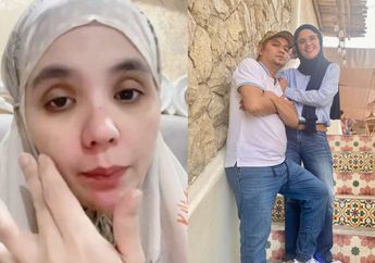 Dianggap Mampu hingga Tuai Kritikan saat Galang Dana RS, Aldila Jelita Kini Kepergok Jual Barang-barang Berharga Ini demi Biayai Pengobatan Indra Bekti