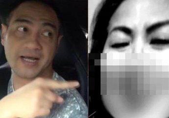 Darah Bercucuran Keluar Dari Hidung, Terungkap Pemicu Luka Venna Melinda Setelah Visum, Ferry Irawan Tega Lakukan Ini
