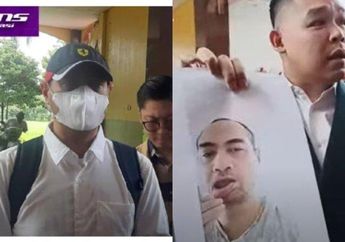 Jalani Pemeriksaan, Ferry Irawan Tunjukkan Bukti Bibirnya Robek Akibat Cakaran hingga Bantah Lakukan KDRT