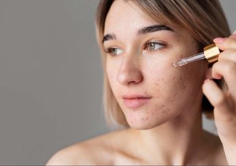 3 Rekomendasi Serum untuk Menghilangkan Bekas Jerawat