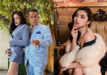 Aspri Hotman Paris Ngaku Dijambak dan Dianiaya sampai Lebam oleh Lelaki di Club, Inilah Sosok Intan Nallendra yang Ramai Disorot