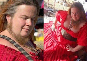 Berjenggot Bak Pria, Wanita Pemilik Janggut Terpanjang di Dunia Mujur di Asmara, Punya Pacar 5 tapi Kondisinya Kini Nahas!