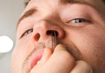 Jangan Sembarangan, Ini 4 Cara Aman Mencabut Bulu Hidung yang Berantakan, Dijamin Gak Iritasi