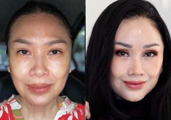Heboh Perubahan Wajah Titi DJ Setelah Lakukan Oprasi Anti Aging di Korea, Bikin Pangling!