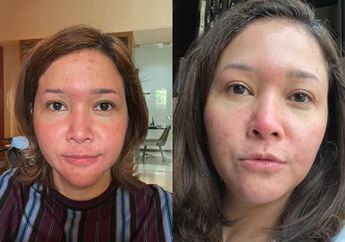 Maia Estianty Sampai Masuk IGD Gegara Mengidap Penyakit ini, Seumur Hidup Tidak Bisa Sembuh