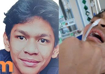 Akun Medsos Buka Donasi untuk David Ozora Korban Penganiayaan Mario Dandy, Keluarga Buka Suara