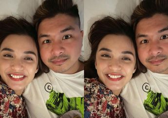 Chelsea Olivia Diprotes Gegara Hilangkan Ciri Identik dari Wajahnya, Istri Glenn Alinskie Ternyata Punya Alasan Khusus!