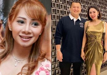 Dulu Dilamar Pakai Cincin Mirip Punya Lady Diana, Femmy Permatasari Bikin Kaget Usai Oplas Wajah, Parasnya Berubah Drastis!