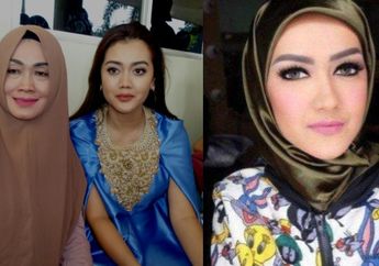 Pendarahan Otak di Depan dan Belakang, Ibunda Mendiang Julia Perez Tak Bisa Dioperasi Gara-gara Kondisi Ini