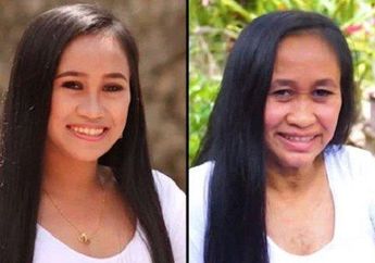 Wanita ini Mendadak Menua Setelah Melahirkan Anak Ketiga, Wajah Kencang dan Cantik Berubah Dipenuhi Keriput