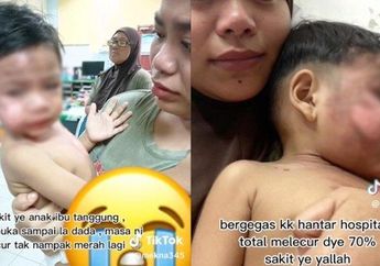 TRAGIS! Hati Ibu Muda Ini Hancur Saat Dapati Wajah Anaknya Tersiram Kuah Ramen Mendidih, Begini Kronologinya