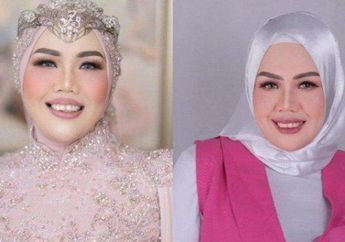 Elly Sugigi Ngebet Operasi Plastik ke Korea Demi Cantik, Bagian Wajah ini Mau Dirombak Habis