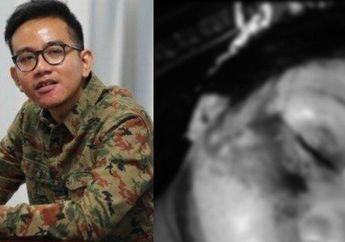 Gibran Rakabuming Raka Soroti KDRT yang Diduga Dilakukan Oleh Dosen UNS, Wali Kota Solo: Laporkan!
