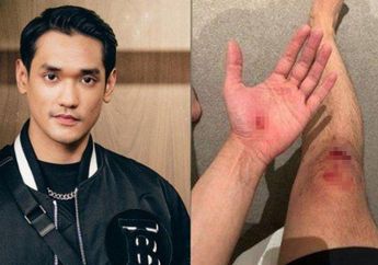 INNALILAHI, Afgan Berdarah-darah Tertimpa Musibah Saat Hari Ulang Tahunnya, Ada Apa Gerangan?