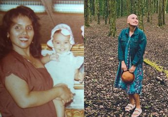 Bayi Kecil Ini Tumbuh Jadi Artis Rupawan, Begini Nasibnya Usai Berjuang Lawan Kanker hingga Rela Gunduli Kepala