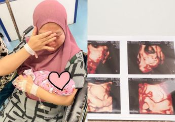 INNALILAHI, Satu Anak Kembar Musdalifah Meninggal Dunia, sang Komika Nelangsa Anak Lainnya Masuk Ruang NICU!