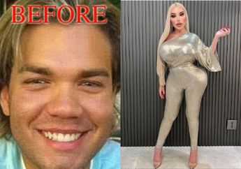 Pria Tampan ini Rela Oplas Agar Jadi Barbie Hidup, Habiskan Rp14 M, Foto Before dan After Bikin Syok