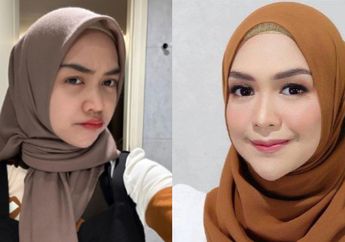 Ria Ricis Operasi Plastik di Hidung, Takut Tak Bangun karena Bius Total